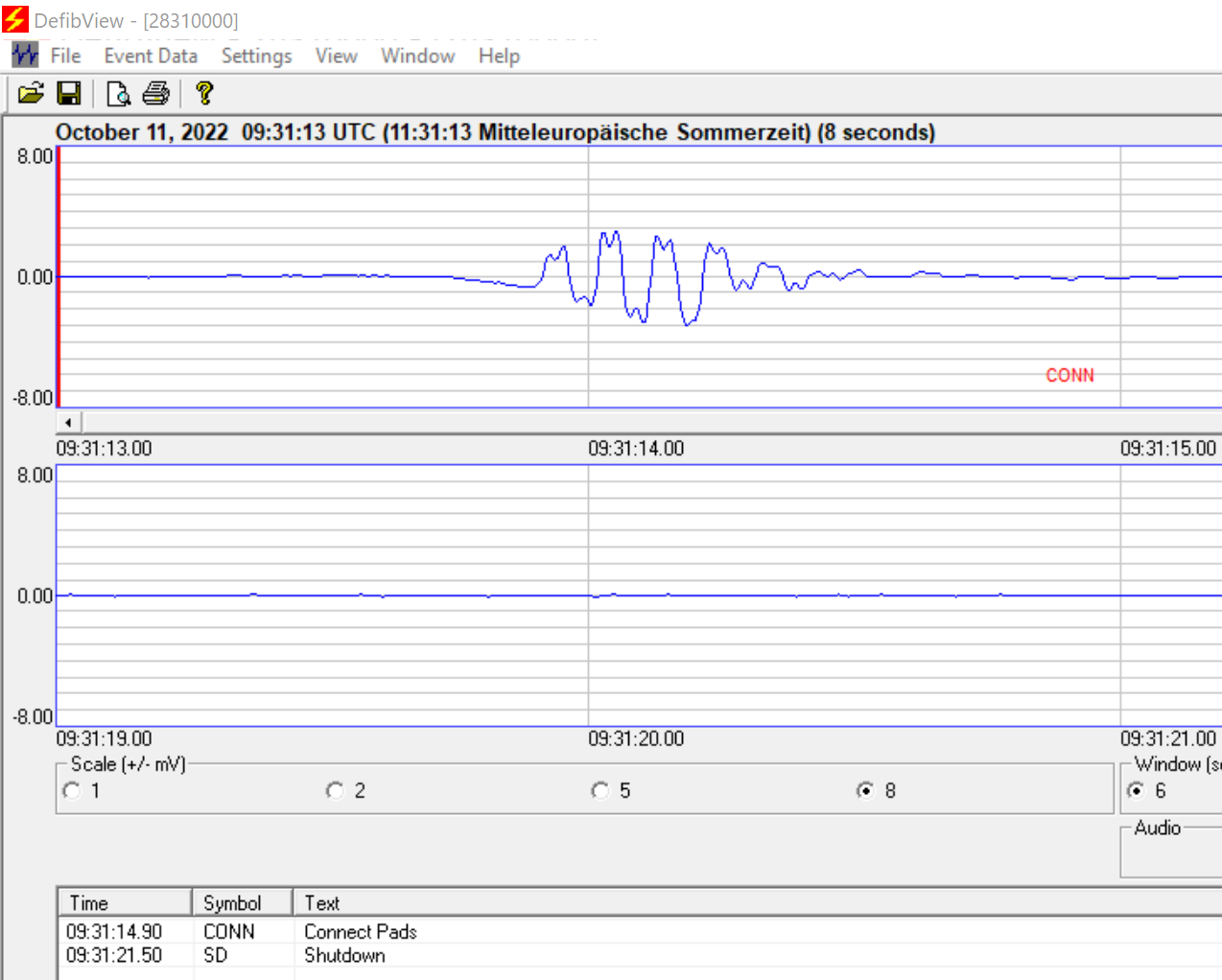 Auslese - Software von Defibtech für Defibrillatoren Lifeline VIEW, Lifeline PRO, Lifeline ECG